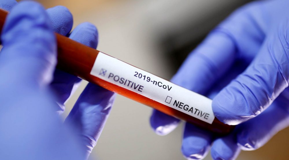 U CG večeras stiglo 2.000 testova na koronavirus, donacije NR Kine i Republike Turske